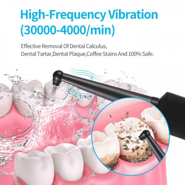 Electric Dental Calculus Remover with LED, High-Frequency Vibration Tooth Tartar Scraper for Teeth Calculus/Tartar/Dental Plaque/Smoke Stain Remover, Professional Teeth Polishing Cleaning Tools
