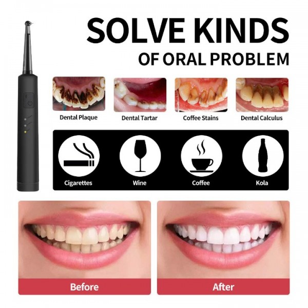 Electric Dental Calculus Remover with LED, High-Frequency Vibration Tooth Tartar Scraper for Teeth Calculus/Tartar/Dental Plaque/Smoke Stain Remover, Professional Teeth Polishing Cleaning Tools